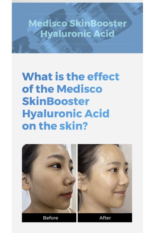 Medisco Skin Booster Hyaluronic Acid
